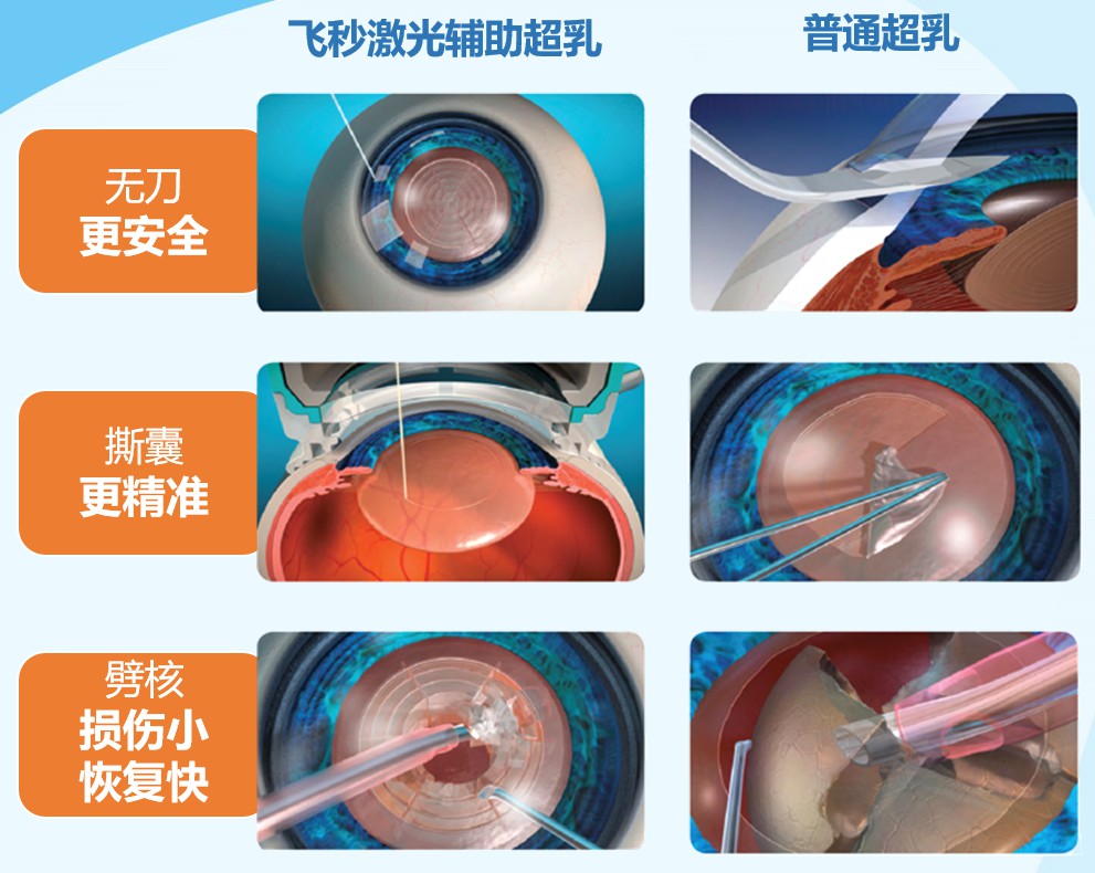 無刀金準 溢顯卓越——華德眼科被授予“飛秒激光白內(nèi)障手